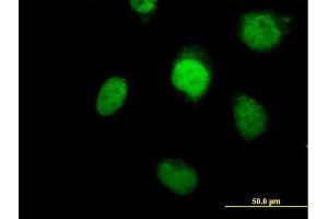 Immunofluorescence of purified MaxPab antibody to POLB on HeLa cell. (POLB antibody  (AA 1-335))