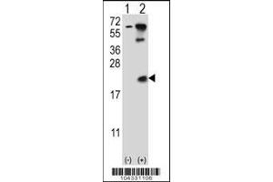 Western blot analysis of UBE2B using rabbit polyclonal UBE2B Antibody (E132) using 293 cell lysates (2 ug/lane) either nontransfected (Lane 1) or transiently transfected (Lane 2) with the UBE2B gene. (UBE2B antibody  (C-Term))