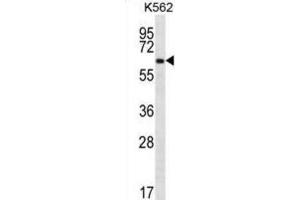 Western Blotting (WB) image for anti-Zinc Finger Protein 623 (ZNF623) antibody (ABIN2996914)