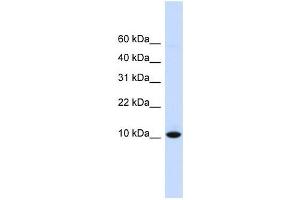 DDT antibody used at 1 ug/ml to detect target protein. (DDT antibody  (N-Term))