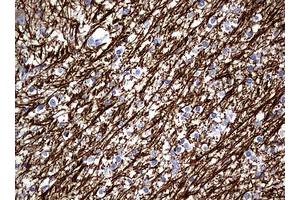 Image no. 2 for anti-Neurofilament, Light Polypeptide (NEFL) (AA 1-360) antibody (ABIN1490762) (NEFL antibody  (AA 1-360))