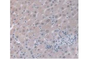 IHC-P analysis of Human Liver Tissue, with DAB staining. (ORM1 antibody  (AA 19-201))
