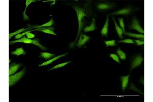 Immunofluorescence of purified MaxPab antibody to ALDH7A1 on HeLa cell.