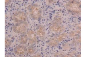 Detection of PIGR in Human Stomach Tissue using Polyclonal Antibody to Polymeric Immunoglobulin Receptor (PIGR) (PIGR antibody  (AA 462-561))