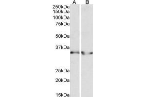 ABIN1782167 (0. (LDHB antibody  (AA 15-25))