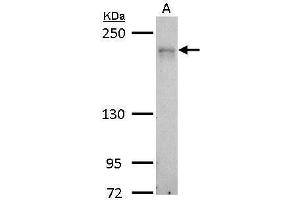 WB Image MRCK alpha antibody detects CDC42BPA protein by Western blot analysis. (CDC42BPA antibody)