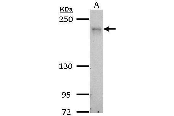 CDC42BPA anticorps