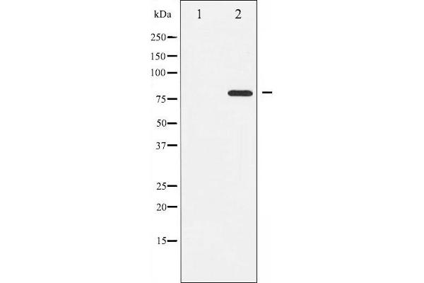 PKC theta antibody  (pSer676)