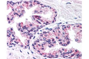 Anti-PHKG2 antibody IHC of human prostate. (PHKG2 antibody  (N-Term))