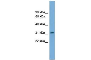 WB Suggested Anti-PIGL Antibody Titration:  0. (PIGL antibody  (N-Term))