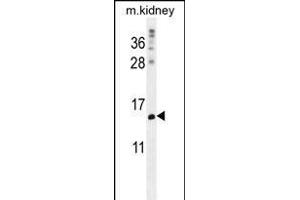 MORN5 Antibody (C-term) (ABIN656139 and ABIN2845478) western blot analysis in mouse kidney tissue lysates (35 μg/lane). (MORN5 antibody  (C-Term))