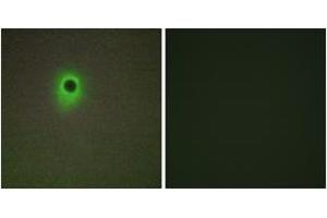 Immunofluorescence analysis of A549 cells, using HIPK4 Antibody. (HIPK4 antibody  (AA 511-560))