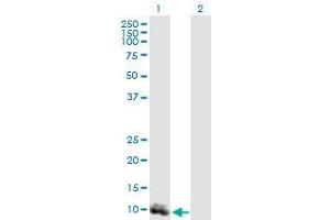 Western Blot analysis of LY6D expression in transfected 293T cell line (LY6D antibody  (AA 21-128))