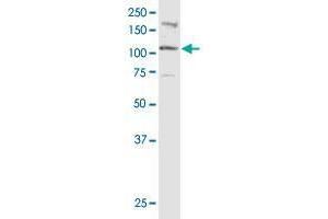Western Blotting (WB) image for anti-Catenin (Cadherin-Associated Protein), delta 2 (Neural Plakophilin-Related Arm-Repeat Protein (CTNND2) (AA 1081-1190) antibody (ABIN560530)