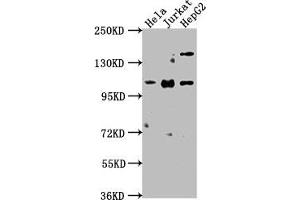 Western Blot Positive WB detected in: Hela whole cell lysate, Jurkat whole cell lysate, HepG2 whole cell lysate All lanes: KSR1 antibody at 1:2000 Secondary Goat polyclonal to rabbit IgG at 1/50000 dilution Predicted band size: 103, 98, 88, 85 kDa Observed band size: 103 kDa (KSR1 antibody  (AA 404-598))
