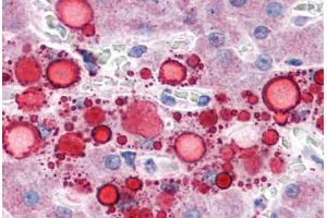 Human Liver, Lipid Droplets: Formalin-Fixed, Paraffin-Embedded (FFPE) (ADRP antibody  (AA 28-281))