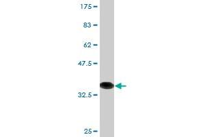 Western Blot detection against Immunogen (36. (SNAPIN antibody  (AA 41-136))