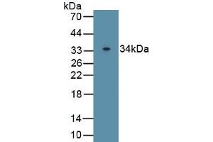 Detection of Recombinant Pgp, Rat using Polyclonal Antibody to Permeability Glycoprotein (Pgp) (Permeability Glycoprotein antibody  (AA 999-1277))