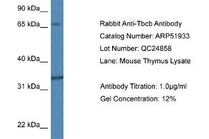 Western Blotting (WB) image for anti-Tubulin Folding Cofactor B (TBCB) (N-Term) antibody (ABIN2784694) (TBCB antibody  (N-Term))