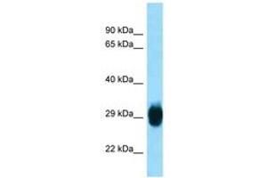 Image no. 1 for anti-Spindle and Kinetochore Associated Complex Subunit 1 (SKA1) (AA 51-100) antibody (ABIN6748283)