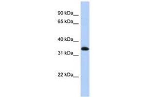 Image no. 1 for anti-Zinc Finger Protein 511 (ZNF511) (N-Term) antibody (ABIN6740520)