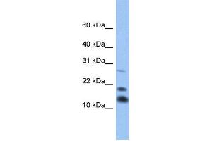 WB Suggested Anti-C1D Antibody Titration:  0. (C1D antibody  (Middle Region))