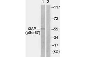 Western blot analysis of extracts from HepG2 cells treated with Anisomycin 25ug/ml 30', using XIAP (Phospho-Ser87) Antibody. (Intestinal Alkaline Phosphatase antibody  (pSer87))