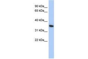 Image no. 1 for anti-MAX Interactor 1 (MXI1) (AA 215-264) antibody (ABIN6742204)