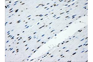 Immunohistochemical staining of paraffin-embedded Kidney tissue using anti-IFIT3mouse monoclonal antibody. (IFIT3 antibody)