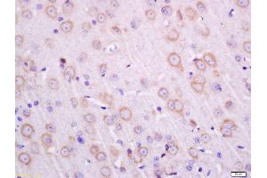 Formalin-fixed and paraffin embedded rat brain labeled with Anti-Transmembrane Protein 30A Polyclonal Antibody, Unconjugated  at 1:200 followed by conjugation to the secondary antibody and DAB staining. (TMEM30A antibody  (AA 251-350))