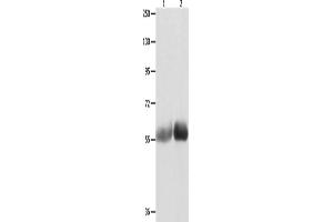 Western Blotting (WB) image for anti-MutY Homolog (E. Coli) (MUTYH) antibody (ABIN2421891) (MUTYH antibody)