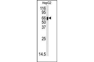 Image no. 1 for anti-Angiotensinogen (serpin Peptidase Inhibitor, Clade A, Member 8) (AGT) (N-Term) antibody (ABIN360211) (AGT antibody  (N-Term))