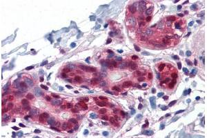 Human Breast: Formalin-Fixed, Paraffin-Embedded (FFPE) (YAP1 antibody  (AA 53-162))