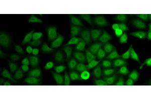 Immunofluorescence analysis of HeLa cells using IMPDH2 Polyclonal Antibody (IMPDH2 antibody)