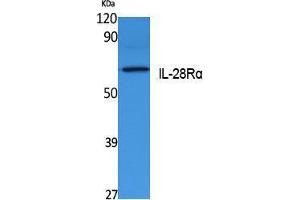 Western Blotting (WB) image for anti-Interleukin 28 Receptor, alpha (Interferon, lambda Receptor) (IL28RA) (Internal Region) antibody (ABIN3180976) (IL28RA antibody  (Internal Region))
