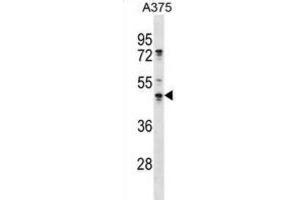 Western Blotting (WB) image for anti-Obg-Like ATPase 1 (OLA1) antibody (ABIN2998785) (OLA1 antibody)