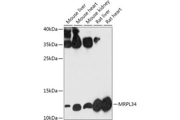 MRPL34 anticorps  (AA 16-92)