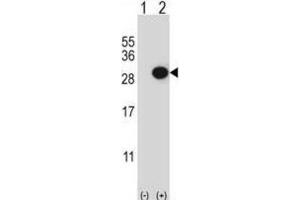 Western Blotting (WB) image for anti-Collagen Triple Helix Repeat Containing 1 (CTHRC1) antibody (ABIN3003906) (CTHRC1 antibody)