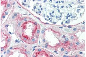 Human Kidney (formalin-fixed, paraffin-embedded) stained with THY1 antibody ABIN396935 at 10 ug/ml followed by biotinylated anti-mouse IgG secondary antibody ABIN481714, alkaline phosphatase-streptavidin and chromogen.