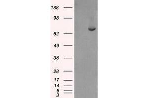 Western Blotting (WB) image for anti-Fermitin Family Member 2 (FERMT2) antibody (ABIN1499049) (FERMT2 antibody)