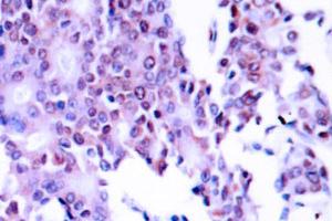 Image no. 1 for anti-Nuclear Factor-kB p65 (NFkBP65) antibody (ABIN271748) (NF-kB p65 antibody)