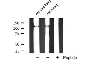 Western blot analysis of extracts of various celllines,using Integrin α3 (CD49c) Antibody. (ITGA3 antibody)