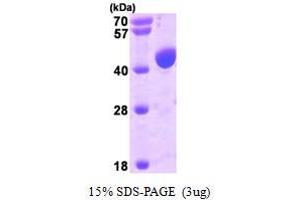SDS-PAGE (SDS) image for Programmed Cell Death 6 Interacting Protein (PDCD6IP) (AA 1-392) protein (His tag) (ABIN666945) (ALIX Protein (AA 1-392) (His tag))