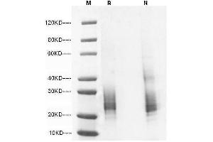 IL-7 Protein (AA 26-154) (His tag)