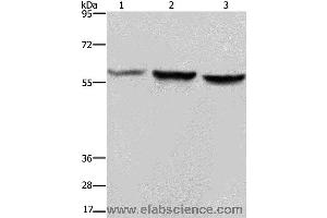 Western blot analysis of Hela, A375 and LoVo cell, using SYN2 Polyclonal Antibody at dilution of 1:1400 (SYN2 antibody)