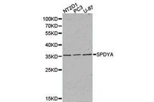 Western Blotting (WB) image for anti-Speedy Homolog A (SPDYA) antibody (ABIN1874919) (SPDYA antibody)