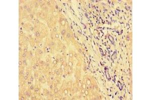 Immunohistochemistry of paraffin-embedded human liver tissue using ABIN7154859 at dilution of 1:100 (HSPA13 antibody  (AA 23-471))