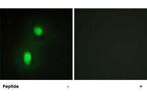 Immunofluorescence analysis of HUVEC cells, using HNRNPC polyclonal antibody .