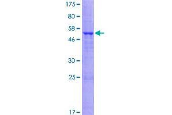 TMEM27 Protein (AA 1-222) (GST tag)