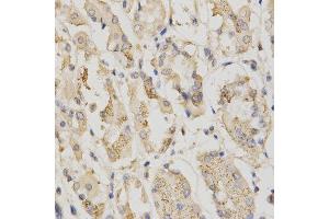 Immunohistochemistry of paraffin-embedded human stomach using STK11 antibody at dilution of 1:200 (x400 lens) (LKB1 antibody  (AA 134-433))